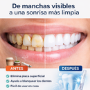 ClearDent Pro® Limpieza profesional en Casa + Gel de regalo